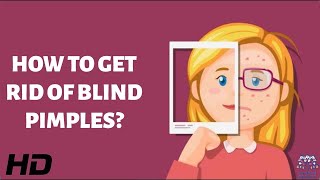 Blind Pimples: How to Eliminate Them Quickly and Effectively