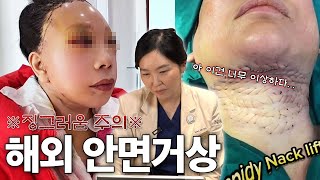 “충격적이네요…”의사가 본 해외 안면거상 수술 리뷰 & 리얼 반응