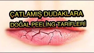 ÇATLAMIŞ DUDAKLARA EVDE YAPABİLECEĞİNİZ ETKİLİ VE HIZLI DOĞAL TARİFLER !!!