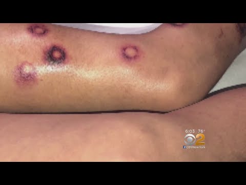 download lagu mp3 mp4 Paintball Bruises, download lagu Paintball Bruises gratis, unduh video klip Paintball Bruises