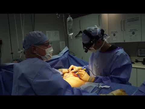FTM Top Surgery | Introduction & Types Of Procedures