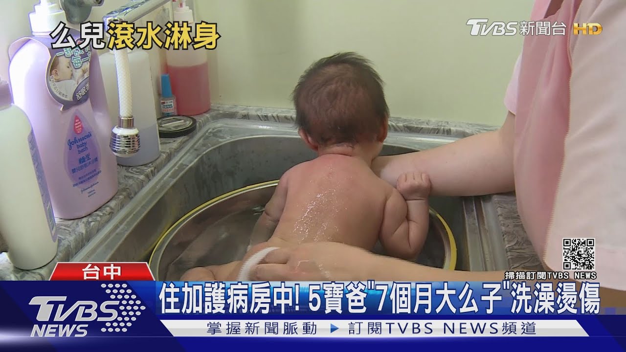 住加護病房中！　5寶爸「7個月大么子」洗澡燙傷