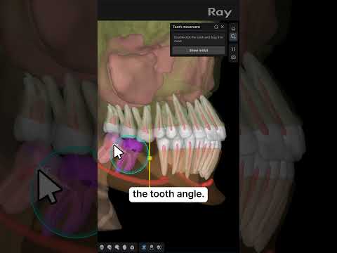 SMARTDent : 5D Tutorial #2-9. Tooth Movement