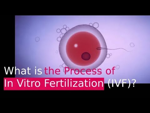 IVF PROCESS: HELPFUL STEP BY STEP GUIDE (In Vitro Fertilization)