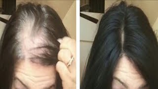 OMG SHOCKING~ Magic Hair Growth Serum - Reduce Hair fall