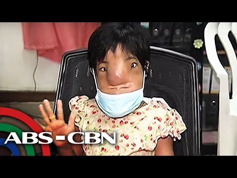 Kung saan mas mahusay na upang simulan upang mawalan ng timbang Internet tungkol pagbaba ng timbang proyekto