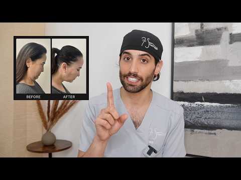 How to Fix an Aging Neck? | Neck Rejuvenation explained by Dr. Sean Saddat