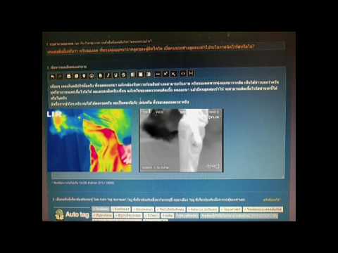 คลิกเพื่อดูคลิปวิดีโอ