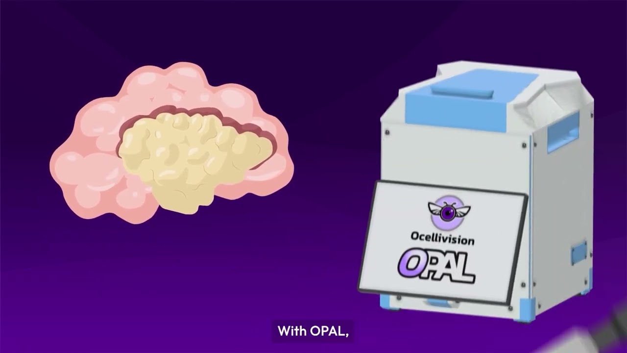 Preview image for the Ocellivision OPAL explained
    YouTube video