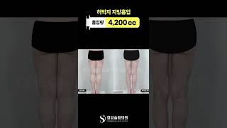 붙던 라인 이렇게 달라짐 ✨