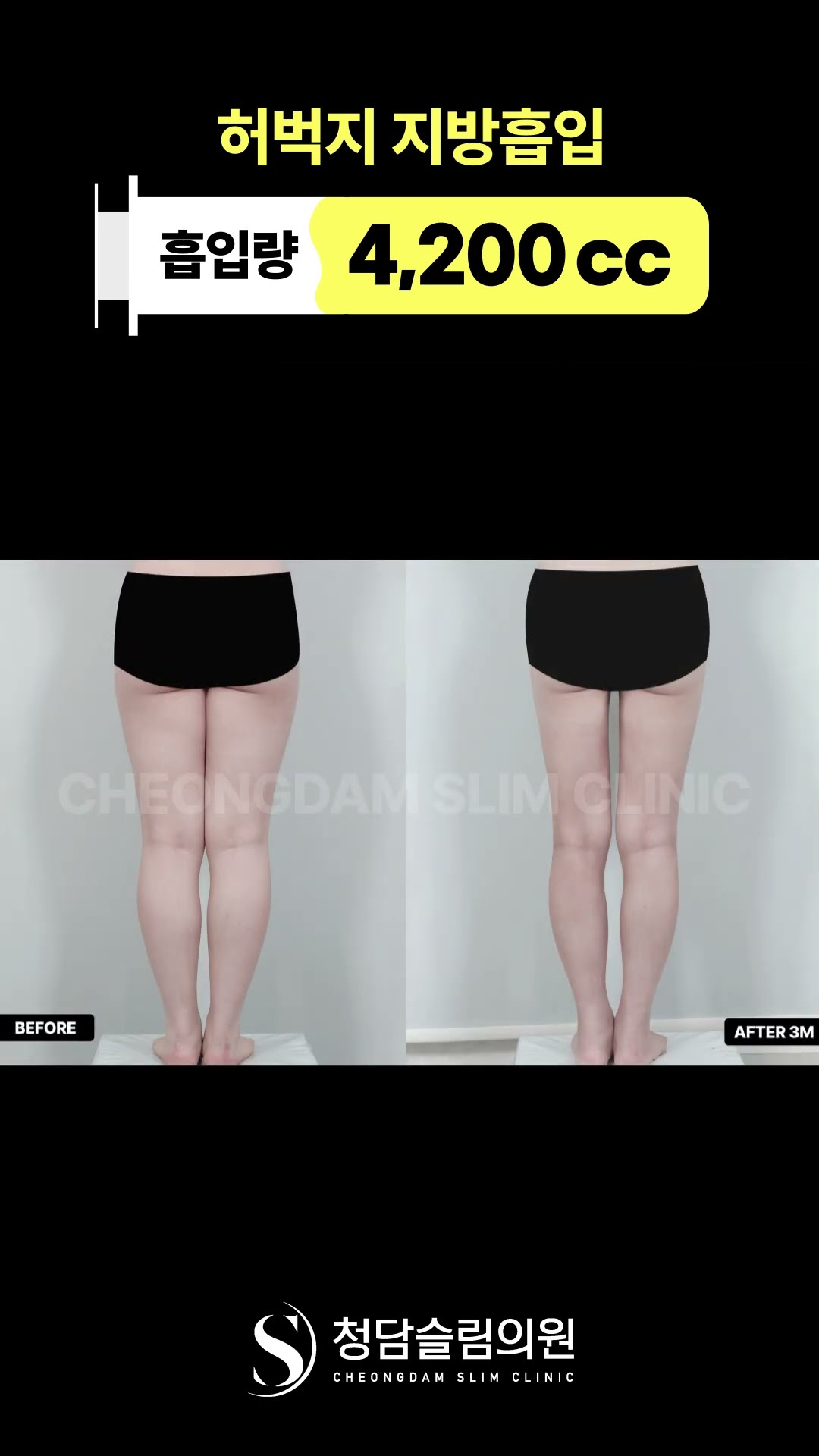 붙던 라인 이렇게 달라짐 ✨