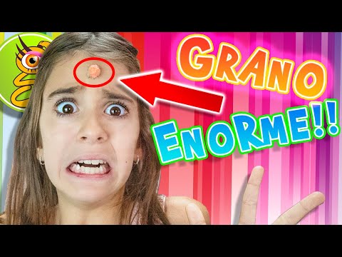 Me sale un ¡¡GRANO ENORME!! el día del BAILE del COLE