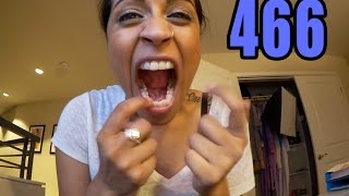 The Time My Mom Tells You Why My Teeth Are Crooked (Day 466)