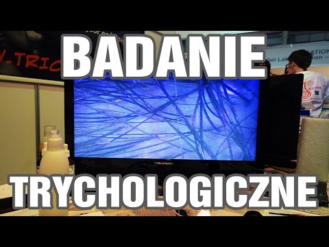 Przyczyny wypadania włosów trichologist Olej kokosowy do włosów przed i po