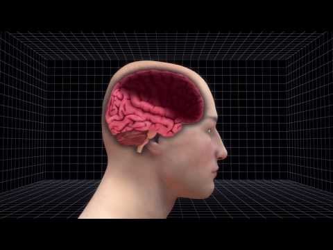 Schumacher's condition stabilizes, doctors perform second operation