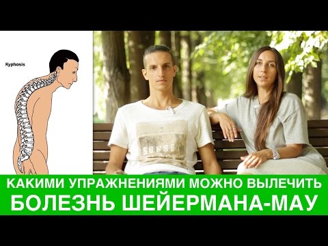 Корректор осанки корсет купить Упражнения от сутулости позвоночника
