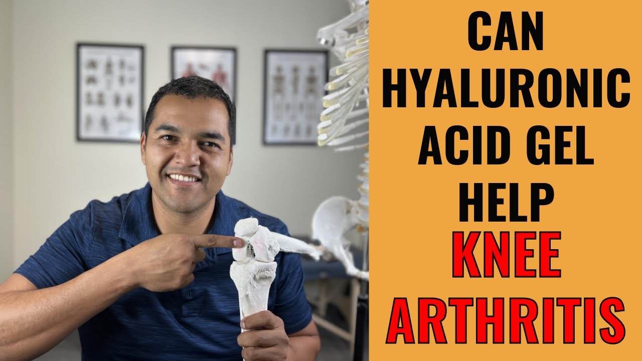 7 Reasons Hyaluronic Acid Gel Injections Might Be Helpful For Knee Arthritis