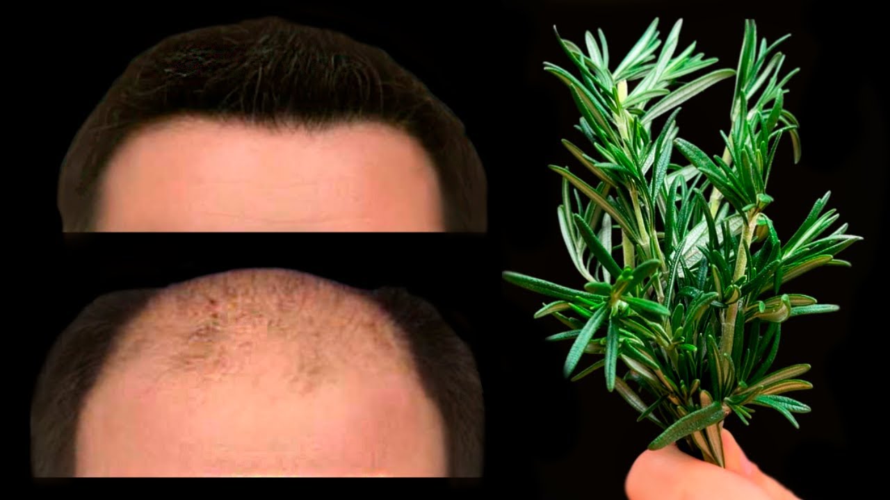 🔥 Just 2 powerful ingredients and your hair will grow like crazy! The best means