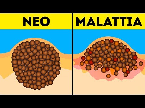 Collettivo coreografico di una lentiggine di tappeti Il trattamento di pigmentary nota su un dorso