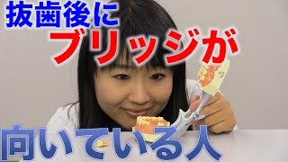 抜歯のあとにブリッジが向いている人