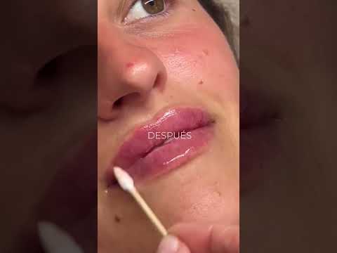 Santé Clínica Estética Barcelona