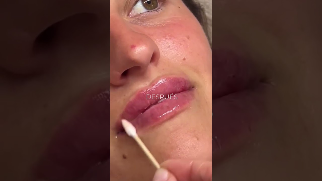 Santé Clínica Estética Barcelona