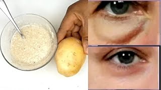 POTATO STARCH will REMOVE EYE BAG AND PUFFY EYE in 3 days