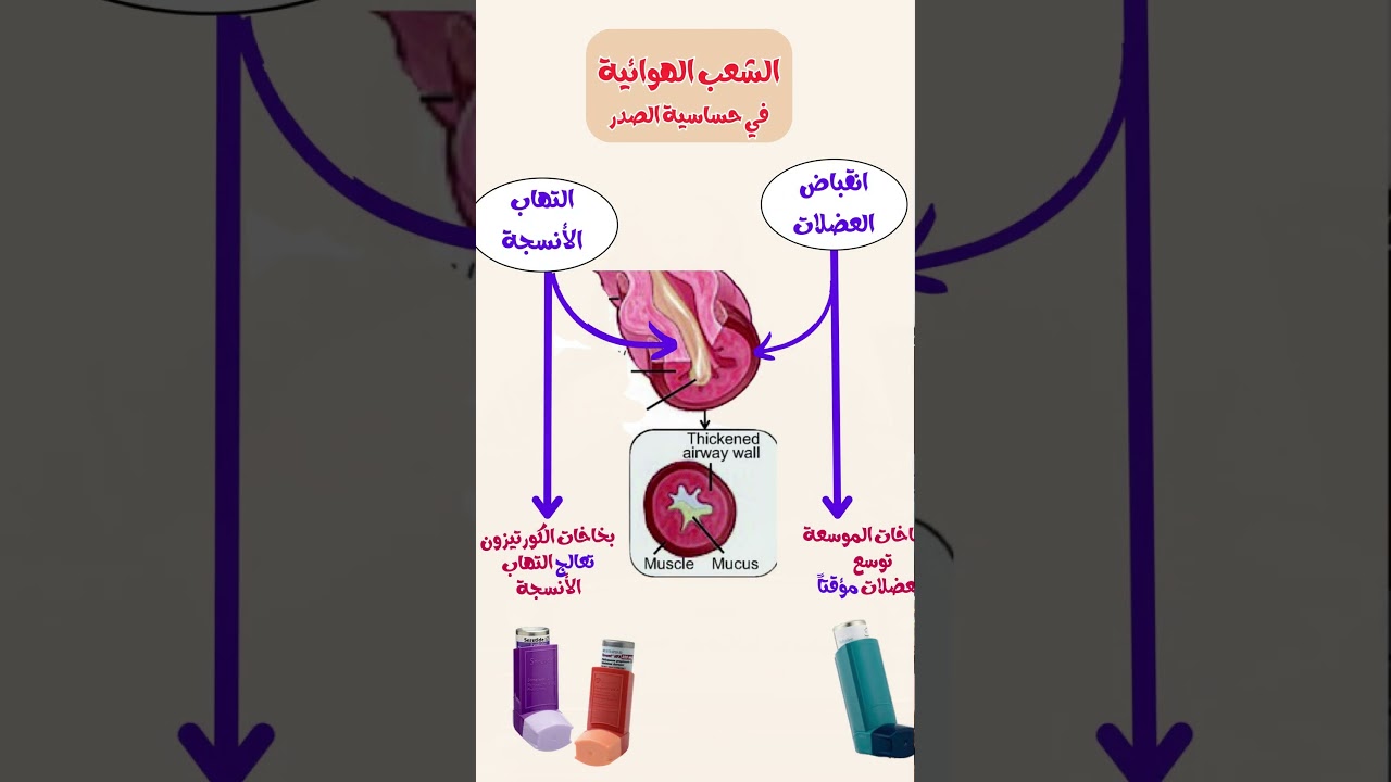 خطأ كبير بنعمله في حق أطفالنا أصحاب حساسية الصدر مهدئات السعال