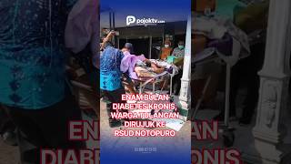 ENAM BULAN ALAMI DIABETES KRONIS, WARGA TULANGAN DIRUJUK KE RSUD NOTOPURO