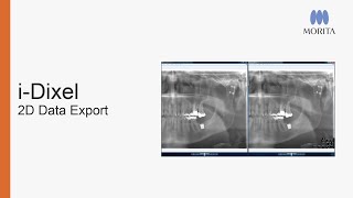 Whether for archiving or sharing with other practitioners, this tutorial will guide you through how to export 2D images from i-Dixel in various…