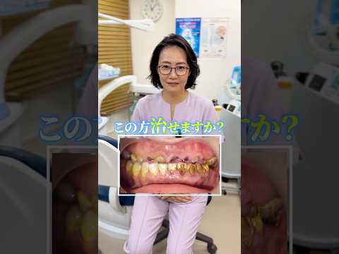 この患者様治せますか？3人目‼️#ザホワイトデンタルクリニック  #歯医者  #歯石除去
