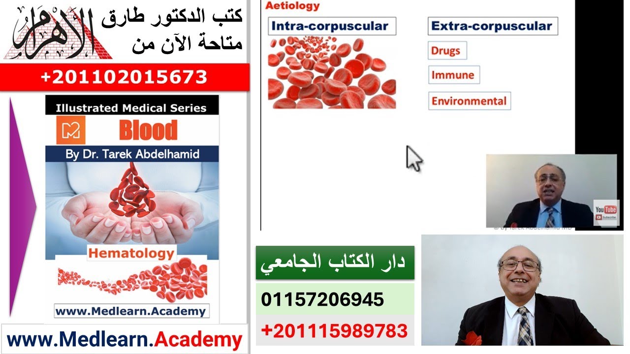 Hemolytic Anemia (General)  #cme #internal_medicine #medical #medicalstudent  #usmle #محاضرات_باطنة