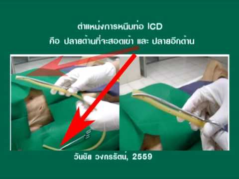 หน้าอกเล็ก Sinelnikov สาวบางเปลือยกายกับหน้าอกเล็ก
