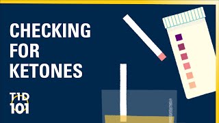 U-M Type 1 Diabetes 101 | Module 2 | Checking for Ketones