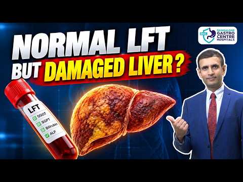 SGPT, SGOT Normal But Liver Damaged? The Hidden Truth About LFT