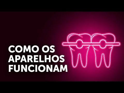 Como funcionam os aparelhos ortodônticos?