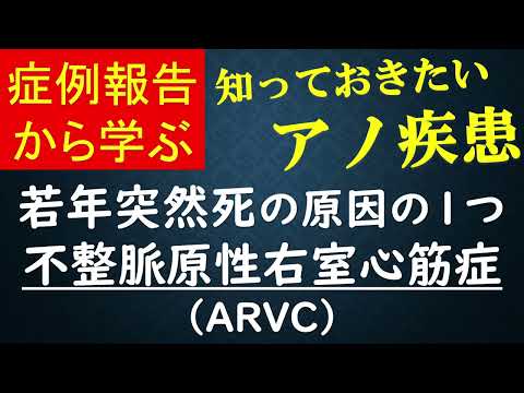 不整脈原性右室異形成 - 定義