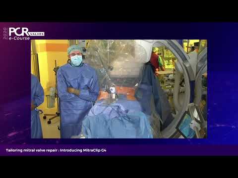 Tailoring mitral valve repair: Introducing MitraClip G4 - PCR Valves e-Course 2020