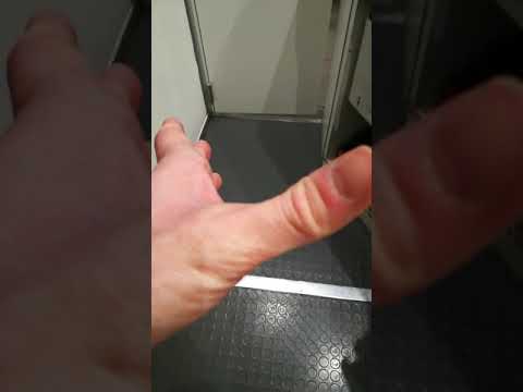 Artrosi dellarticolazione del gomito sul ICD-10 Giunti Uzi negli adulti