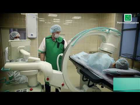 Мобильный рентгеновский аппарат Электрон СРТ