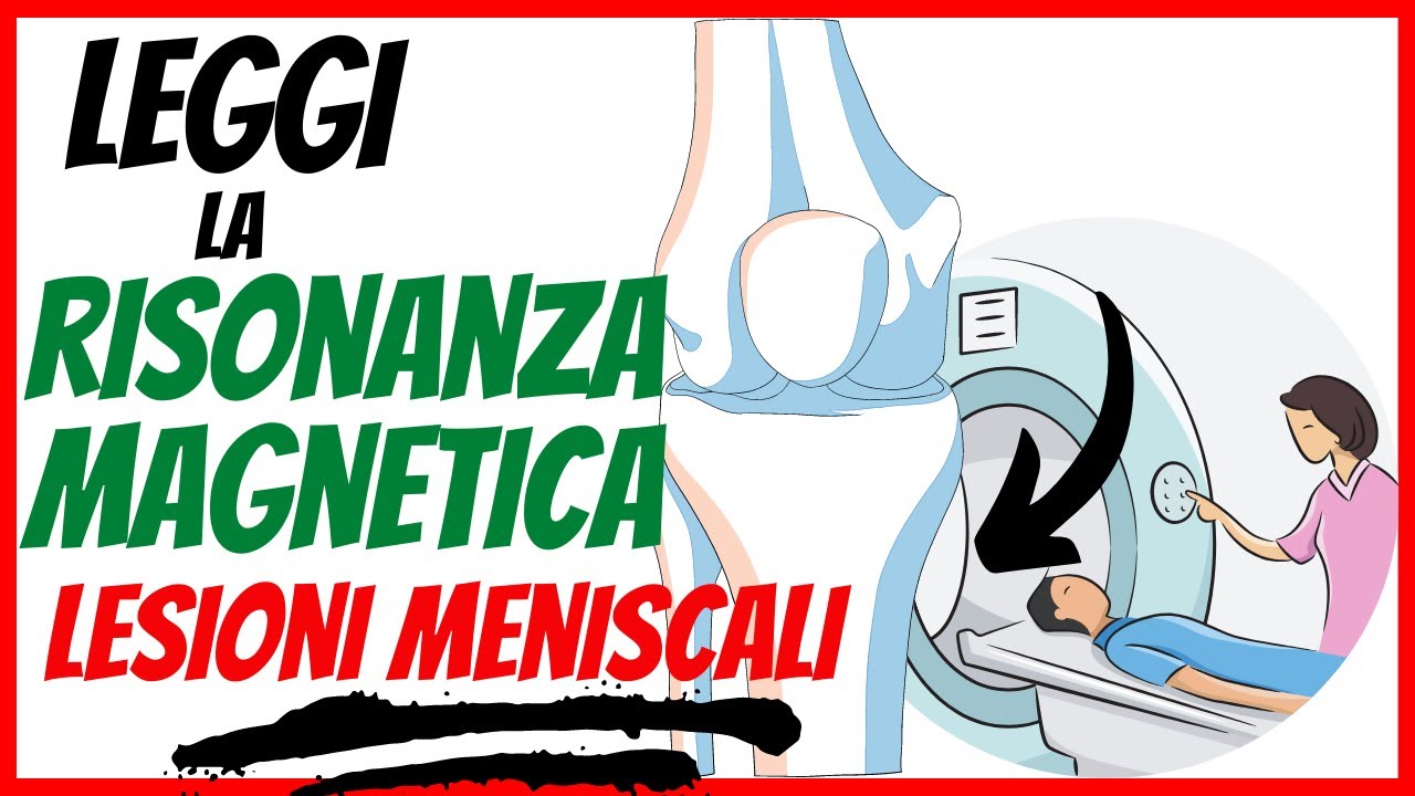 Watch Now Risonanza magnetica: come LEGGERLA | Le LESIONI MENISCALI | Episodio 4 Risonanza magnetica: come LEGGERLA | Le LESIONI MENISCALI | Episodio 4