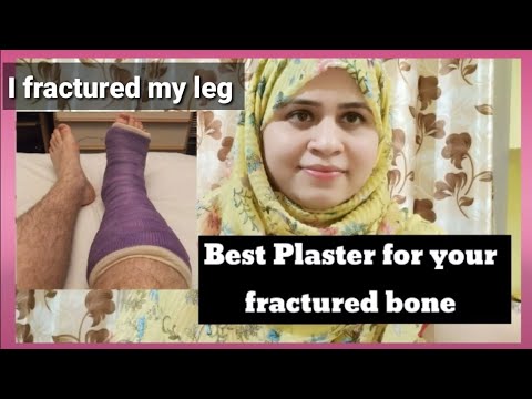 which plaster is best for your fractured bone.True Review of fiberglass cast plaster.Fiberglass cast