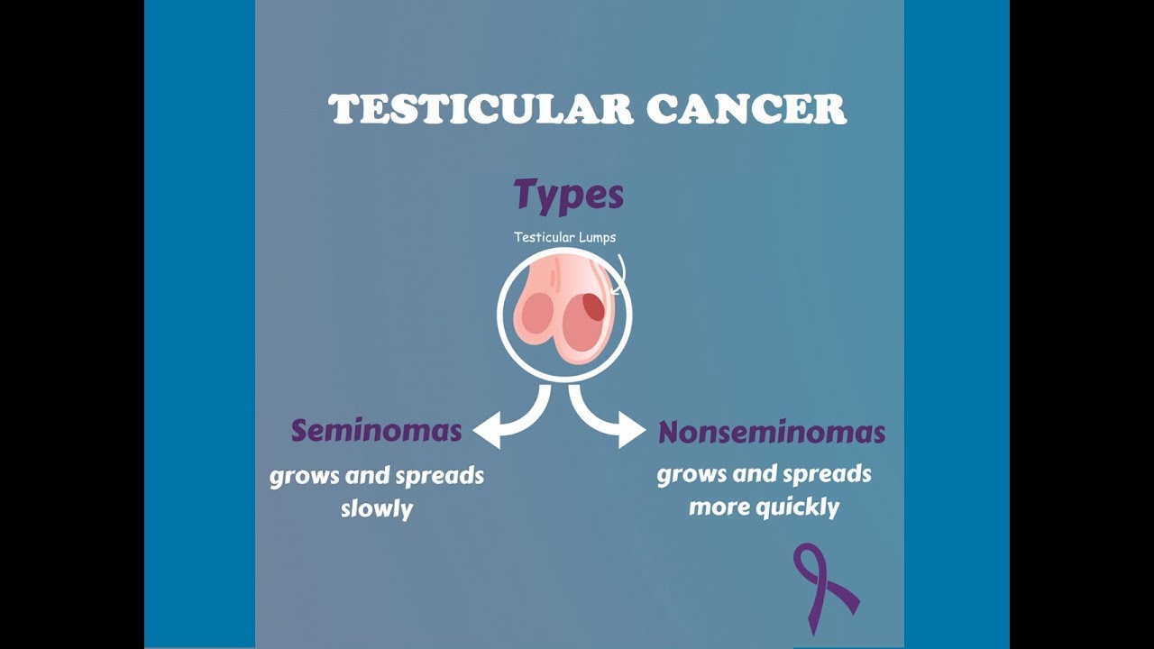 Testicular Tumors Pathology (1) | You won't forget it !