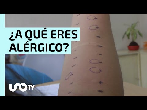 ¿Cómo son las pruebas para detectar alergias?