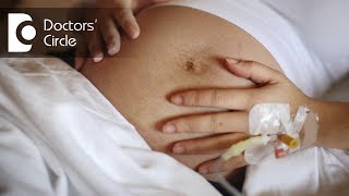 Can women with Cervical stitches walk during pregnancy? - Dr. Shefali Tyagi