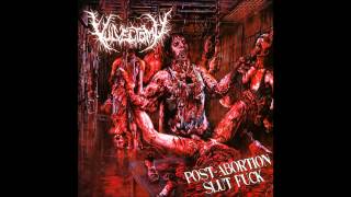 Vulvectomy - Post-Abortion Slut Fuck (Full Album) 2010 (HD)