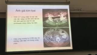 DAI CUONG CT BUNG CHAU  TT