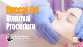 Buccal Fat Removal Surgery | Cheek Fat Reduction | Face slimming| Dr Rajat Gupta | RG Aesthetics