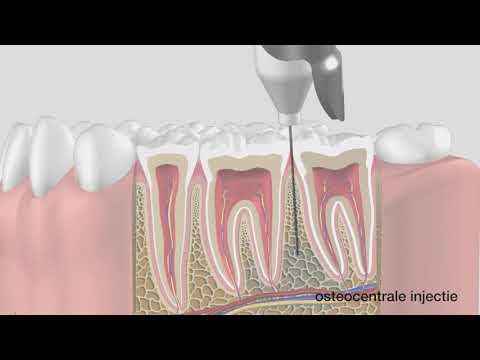 Hoe werkt de QuickSleeper? (schematische uitleg)