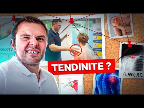 Miniature YouTube : tendinites de la coiffe des rotateurs